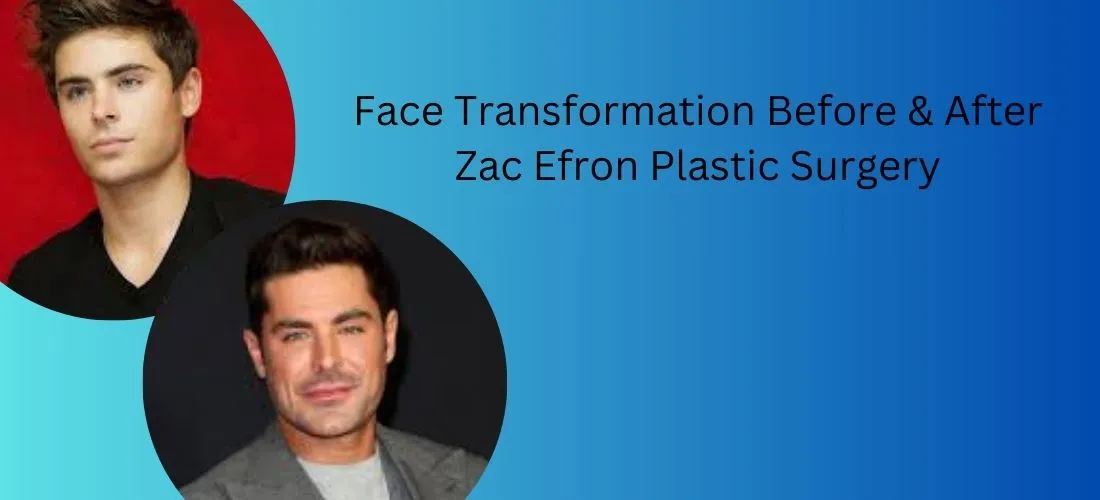 Zac Efron Plastic Surgery Face Transformation Before After Surgery